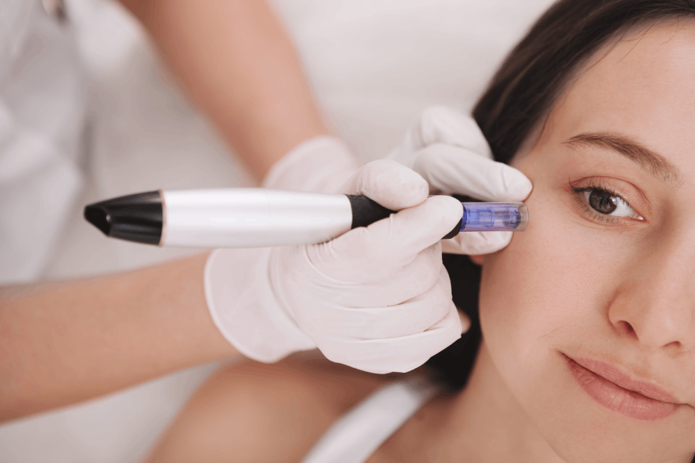 Procell Microchanneling Facial in Bronxville NY
